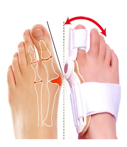 Corrector Juanetes Ortesis Hallux Valgus // Gyb Store.