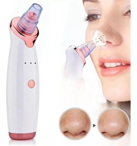 Limpiador Facial Eléctrico Extractor Puntos Negros Vacuum