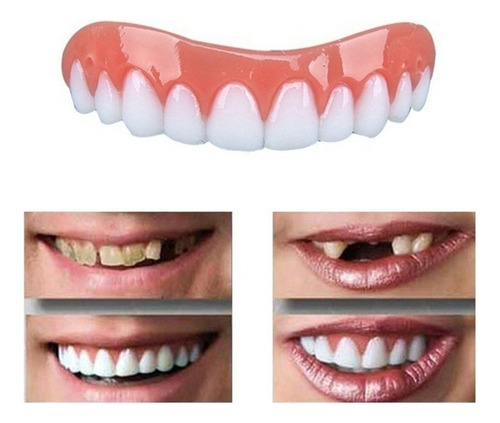 Paquete De 2 Dientes Falsos Profesionales De Silicona Bright