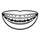 Vinil Decorativo Oficina Dentista Bracetes Labios Sonrisa 
