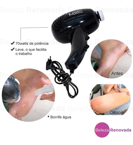 Esfoliantes E Arquivos Eletrônicos Para Manicure E Pedicure  Mega Bellpedicuro Profissional Preto Para Lixar Os Pés 220v Mega Bell 220v 