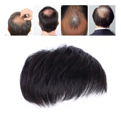 Pelucas Toppers Clip Para Hombre Sobre Mechones De Pelo Negr