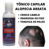 Loção Cura Calvície Careca Nasce Cresce Cabelo Barba Origina