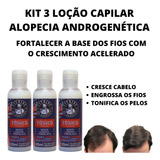 3 Loção Fortalece Cabelos Fracos Anti Alopecia Androgenética