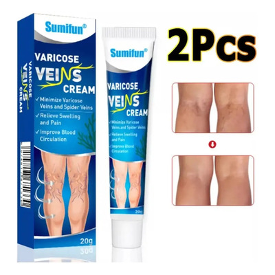 Pomada Tratamento Varizes Vasinhos Nas Pernas Creme 2