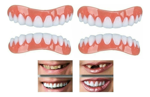 Paquete De 2 Dientes Falsos Profesionales De Silicona Bright