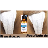 Clareador Corporal Axilas E Virilhas Ácido Retinoico 30 Ml