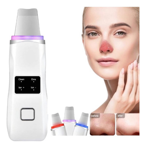 Skin Scrubber Ems Ultrasonic Iones Spa+ Display