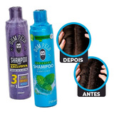 Shampoo Anti Caspa E Nixidil Dom Pelo 3 Em 1 Mentol
