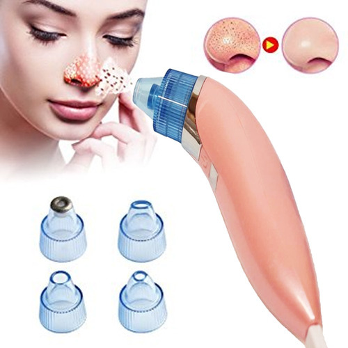 Removedor Facial Extractor Puntos Negros Recargable