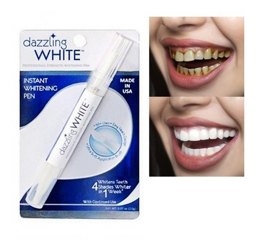 3 Caneta Clareadora Dental Bright White Sorriso