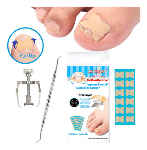 Kit De Corrección De Uñas Encarnadas Para Dedos De Los Pies