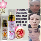 Crema Rosa Mosqueta Y Jabón, Manchas,paño,líneas Expresión 