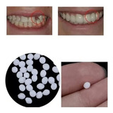 Bolinhas Moldáveis - Restauração Para Os Dentes - 10 Gramas