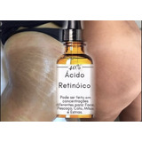 Clareador De Estrias ( Àcido Retinoico 40% ) 30 G