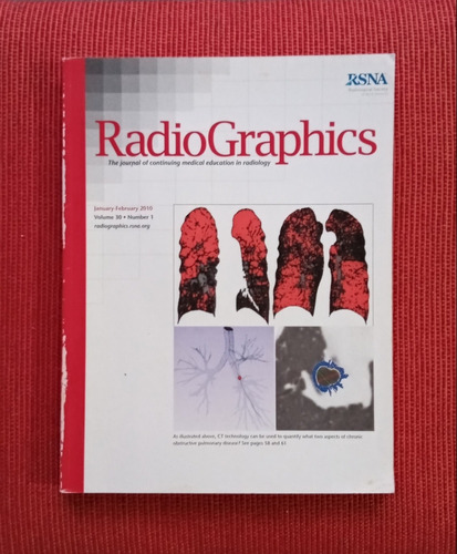 Livro: Radio Graphics - Number 1 - Volume 30