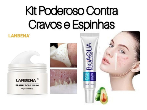 Removedor De Cravos Lanbena + Creme Secativo Espinha Bioaqua