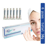 Effezel 0.1% Total 30gr Kit 6 Cremas De 5gr Anti Acné