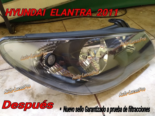 Fondo Negro Titanio,reparaciones Faros Foco Hyundai Elantra  Foto 5