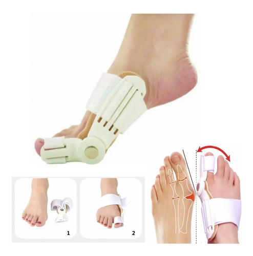 Corrector Juanetes Ortesis Hallux Valgus / Tucupon