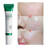 Tratamento Para Espinhas Efetivo Anti Acne 