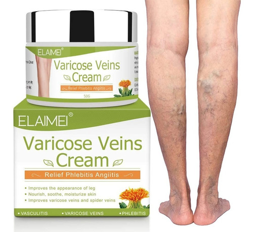 Crema Para Varices Alivia Dolor Venas Elaimei