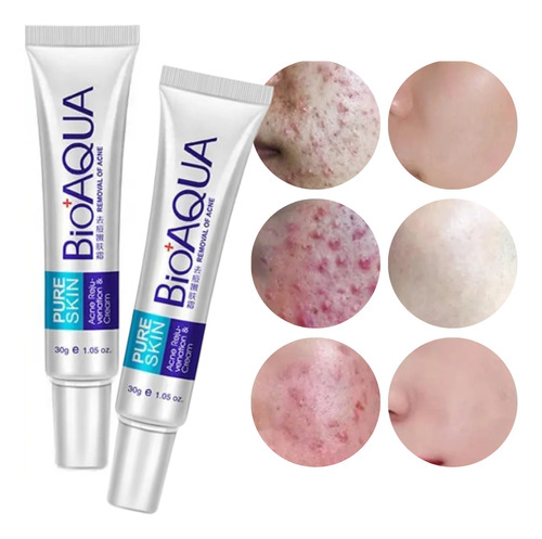 Bioaqua Acne Cream Cicatrices Poros Control De Grasa 2p Full