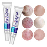 Bioaqua Acne Cream Cicatrices Poros Control De Grasa 2p Full