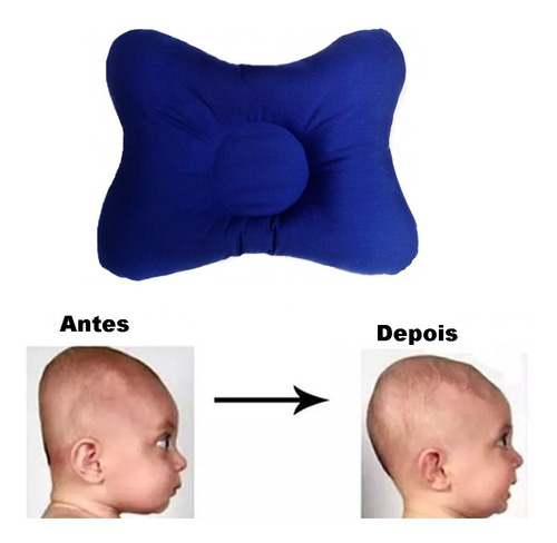 Travesseiro Bebê Anatômico Não Achata A Cabeça Promoção