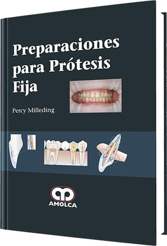 Preparaciones Para Prótesis Fija