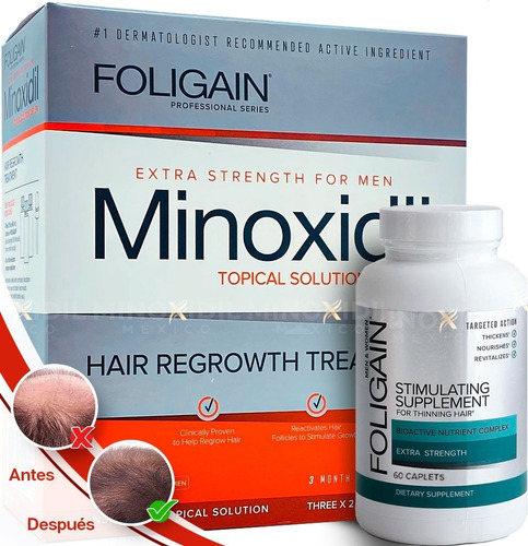 Minoxidil 5% Formula Original + Foligain Tabs 60 Caps