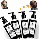 Kit C/ 4 Escurecedor De Barba Cabelo Black You Man + Brinde