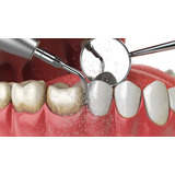 Limpieza Dental Con Ultrasonido+ Brochita + Flúor 