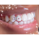 Strass Dental X 80 Unidades + 7 Mariposas Dentales