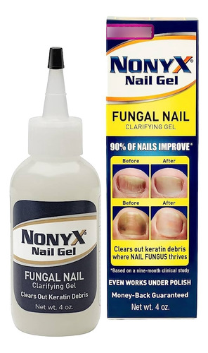 Esmalte Nonyx Anti Hongos Uñas Pies Fungal Nail Treatment 