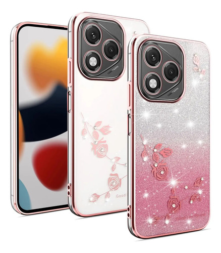 Funda Para Honor 400 Lite 5g Transparente Con Purpurina Ultrafina Y A Prueba De Golpes Elegante Para Mujeres Y Niñas