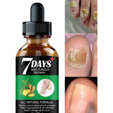 Tratamiento En Uñas Pie Con Hongos Onicomicosis Serum 10 Ml