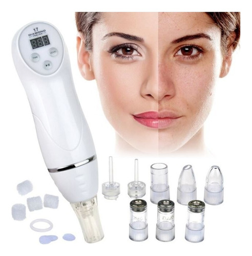 Máquina Limpieza Facial Microdermoabrasión Diamante Peeling