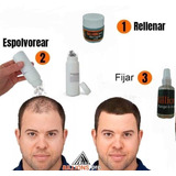 Kit Fibras Capilares/cabello/ Billions Pro/no Toppik/barberi