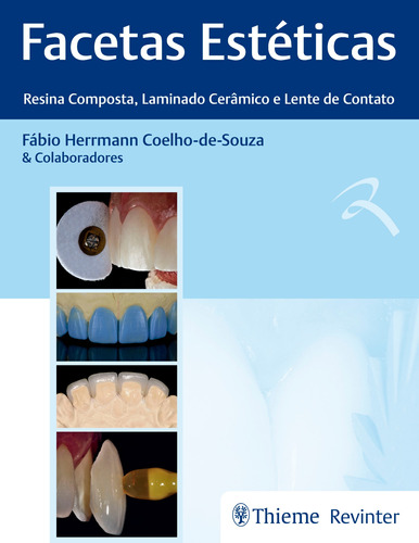 Facetas Estéticas  Resina Composta, Laminado Cerâmico E Lente De Contato, De Coelho-de-souza, Fábio Herrmann. Editora Thieme Revinter Publicações Ltda, Capa Dura Em Português, 2018