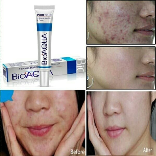 Bioaqua Crema Original Anti Acné Control Grasa Cierra Poros