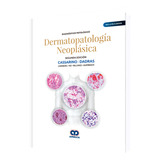 Diagnóstico Patológico Dermatopatología Neoplásica 2da Ed., De David Cassarino., Vol. 1. Editorial Amolca, Tapa Dura En Español, 2019