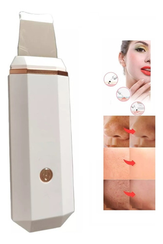 Paleta Ultrasonica Peeling Ultrasonico Limpieza Facial