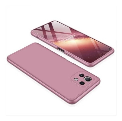 Funda 360° Xiaomi 11 Lite 5g Ne / Mi 11 Lite 5g + Glass