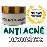 Control Acne - Crema Facial Lib - g a $2667