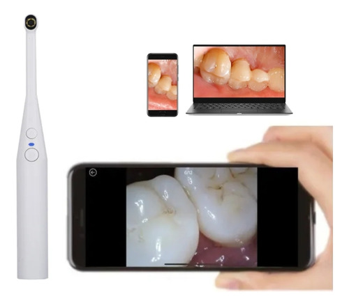 Câmera Usb Intraoral Dental P/ Notebook E Celular Hd Pro
