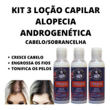 Kit Tônico Loção Capilar Cura Calvície Cresce E Nasce Cabelo