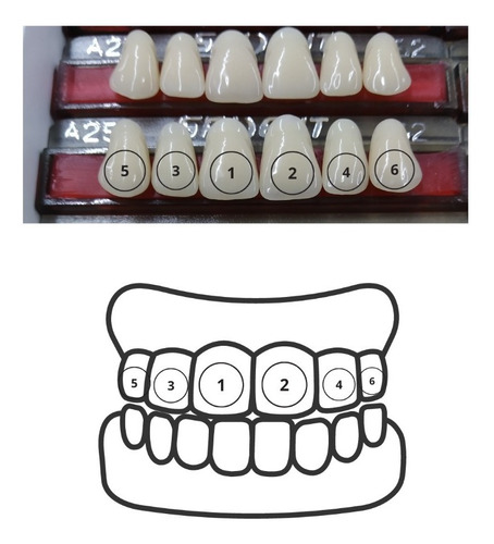Dentes Resina Avulsos Placa. Postiços, Provisórios -superior