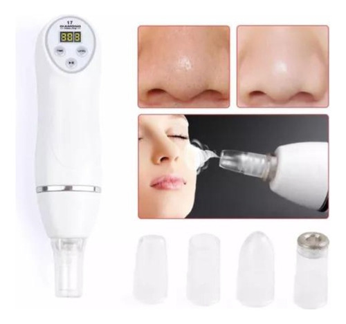 Diamond Peeling Microdermoabrasi - Unidad a $110999