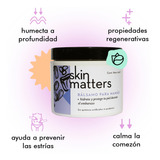 Skin Matters Bálsamo Antiestrías P/ Embarazo Crema Intensiva